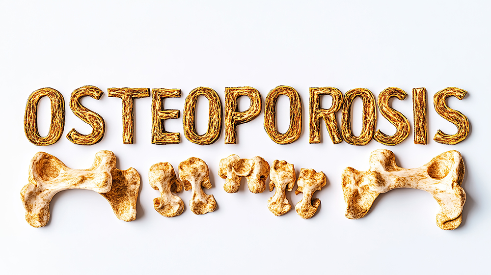 골다공증에 좋은 음식