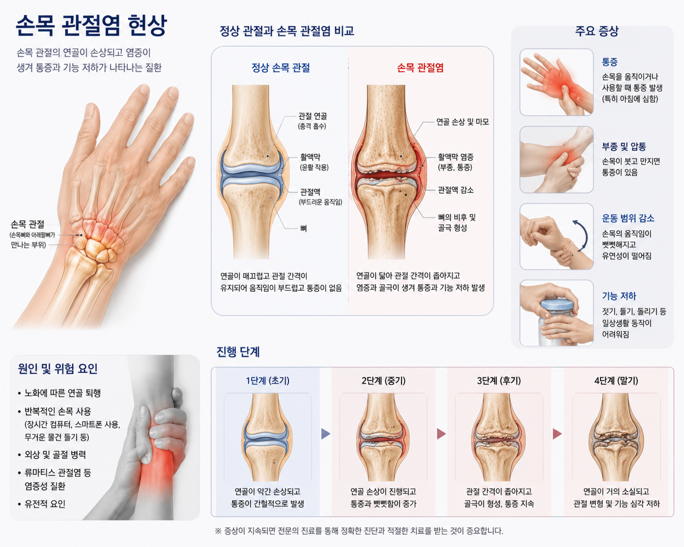 손목 관절염 현상 및 증상