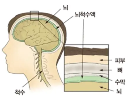 일본뇌염