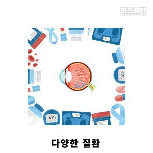 백내장 증상 원인