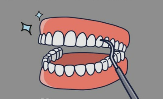 스케일릴으 표현하고 있다.