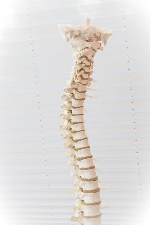 척추측만증 (scoliosis)원인 증상 및 치료법