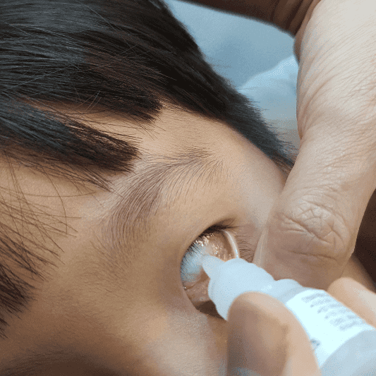 감기와-결막염-눈곱-감기-안약-넣는-법