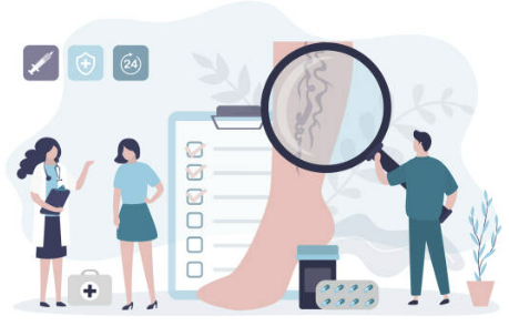 하지정맥류 증상 좋은운동 치료방법 총정리(최신)