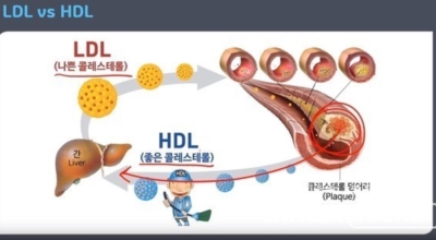 콜레스테롤 이미지