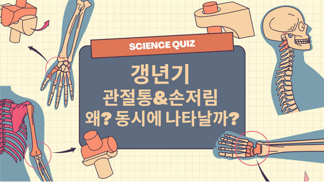 갱년기 관절통 & 저림 증상 총정리 ❘ 50대 여성 건강 가이드