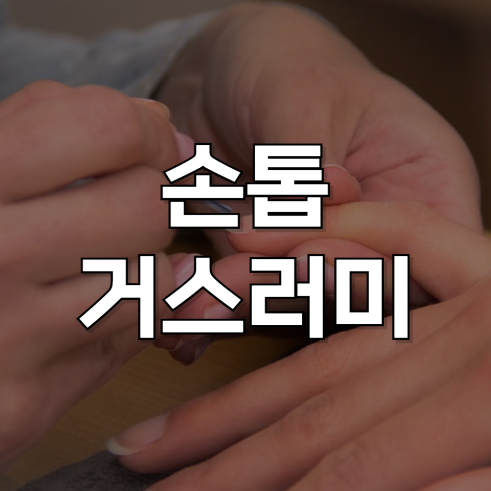 손톱 거스러미 해결법: 염증 대처법과 관련 제품 추천까지 한 번에!