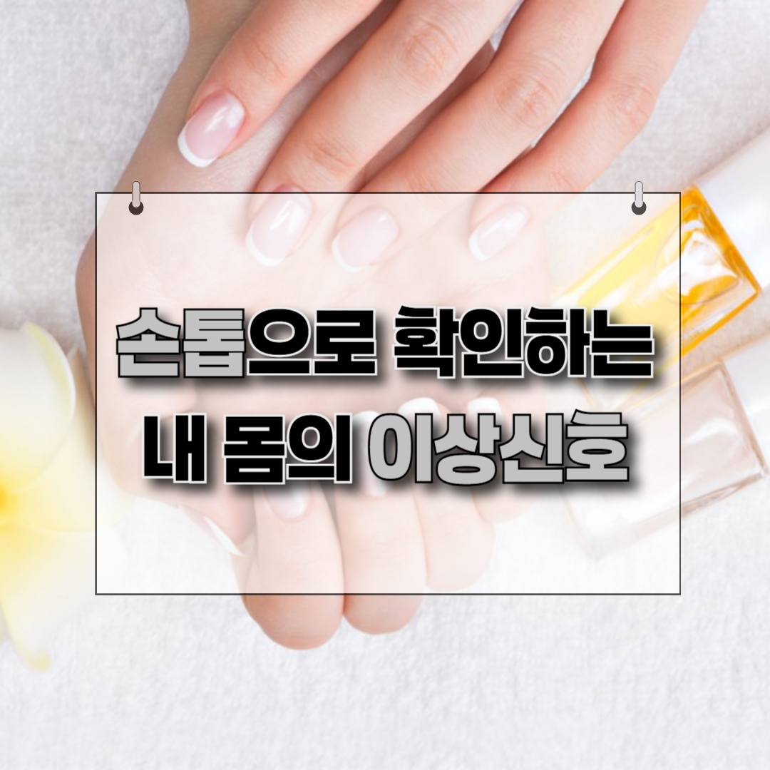 손톱으로 보는 건강 이상 신호 제목을 알리는 이미지