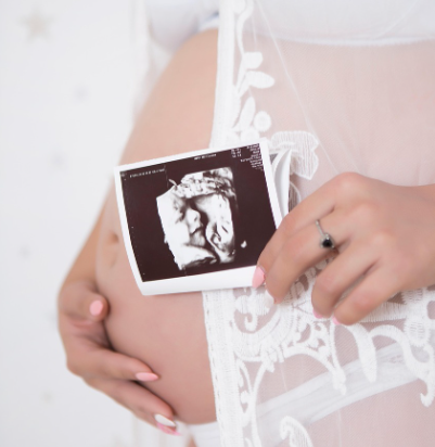 아기 초음파 사진을 들고 있는 임산부의 배사진