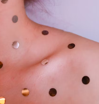 아토피 피부염 진단 기준 치료법 합병증