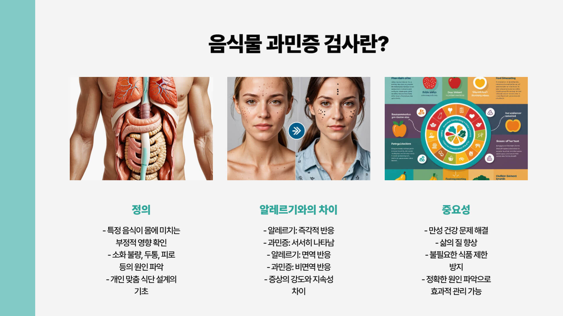 음식물 과민증 검사