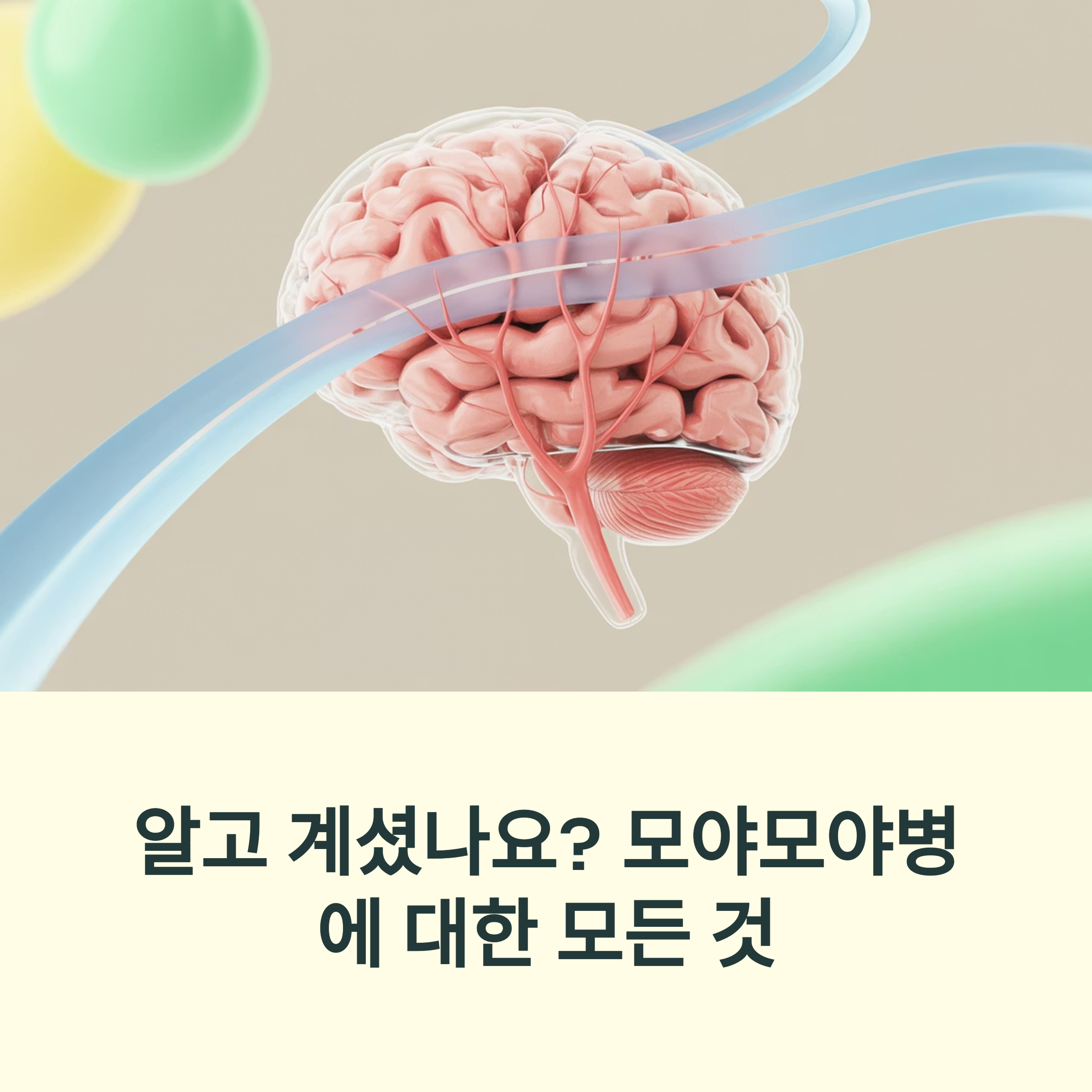 모야모야병, 뇌혈관 속 조용한 폭풍을 아시나요?
