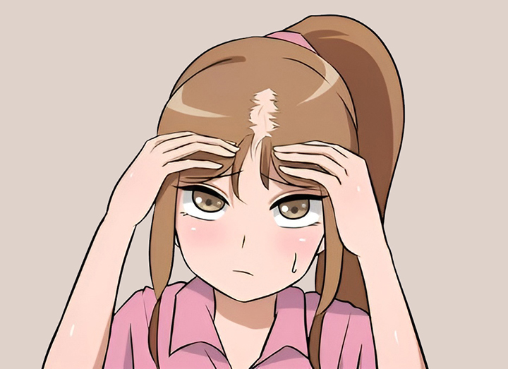 탈모가-진행중인-여성