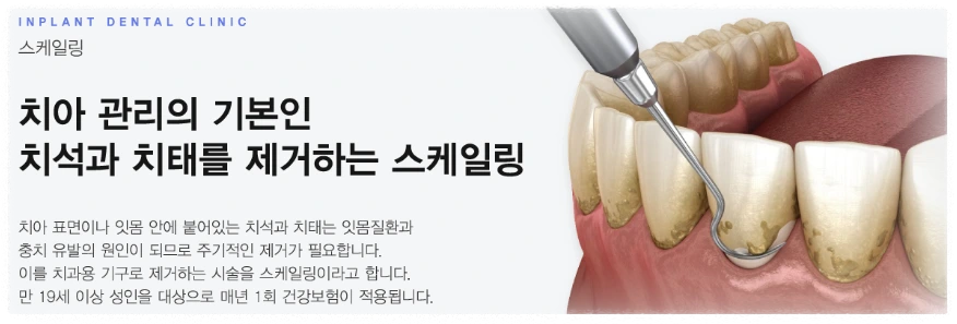 스케일링이란?