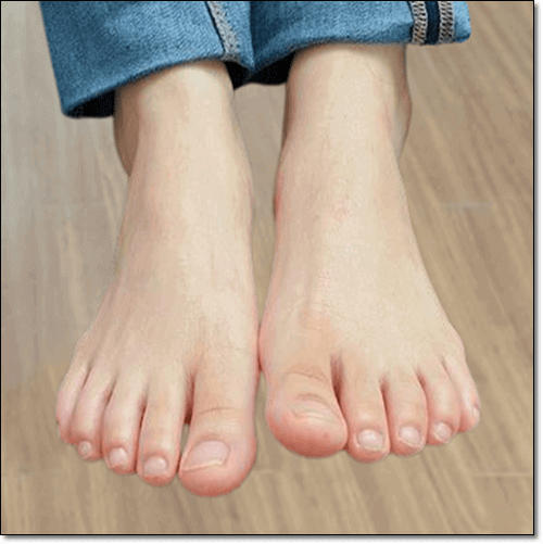 망치족지 원인