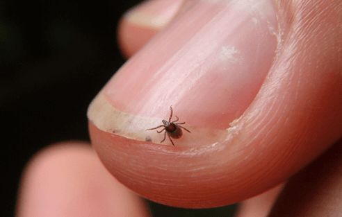 쯔쯔가무시 치료법