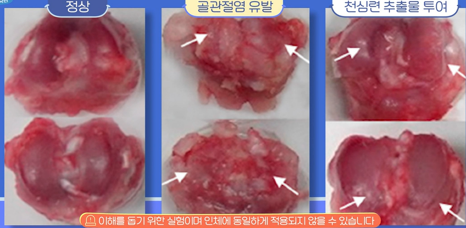 천심련 효능