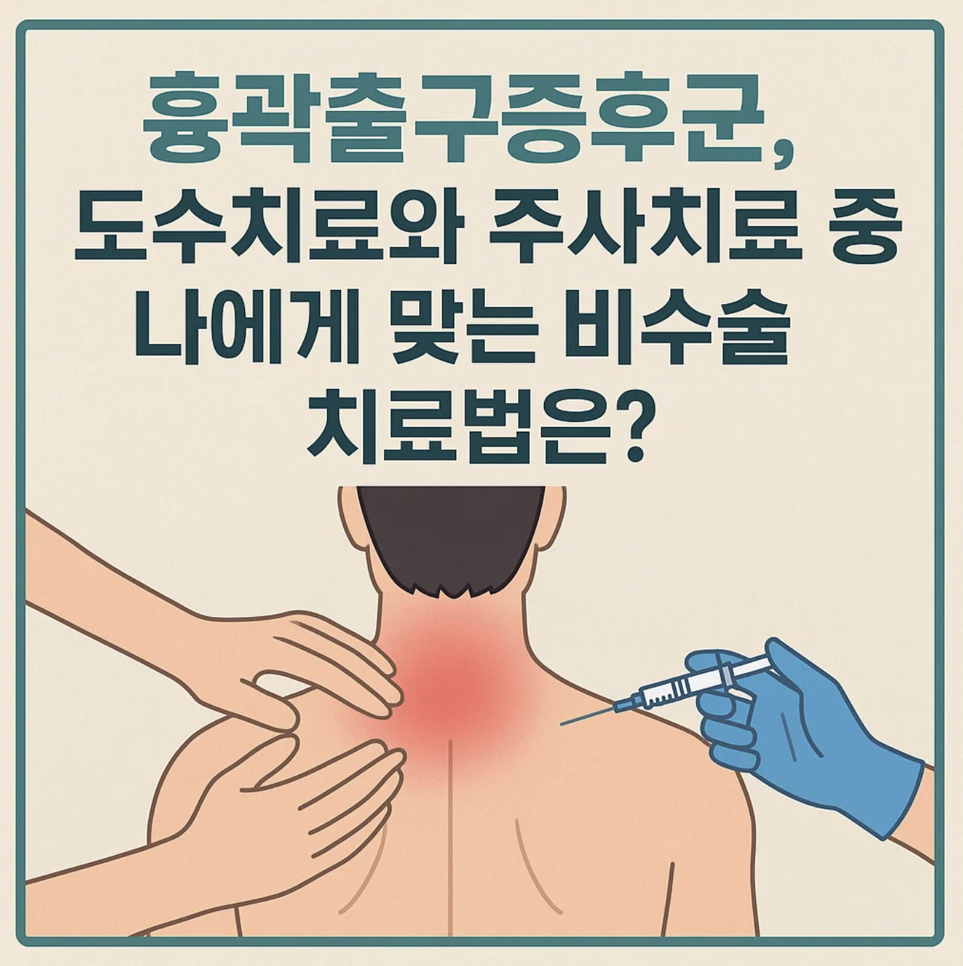 흉곽출구증후군, 도수치료와 주사치료 중 나에게 맞는 비수술 치료법은?