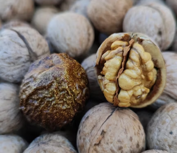 이명에 좋은 음식 영양제 식단