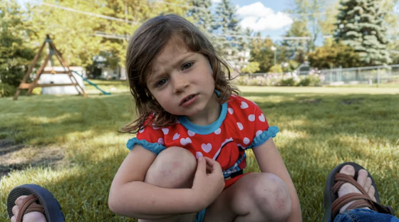 구획증후군 치료 응급 질환 대응 방법