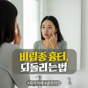 * 이미지 프롬프트: 밝은 자연광이 들어오는 #모던 #미니멀 #깨끗한 욕실. **30대 한국인 여성(이목구비가 뚜렷하고 깨끗한 이미지의 얼굴)**이 거울을 보며, 비립종을 잘못 짠 듯한 **눈 밑의 붉거나 거뭇한 자국(색소침착)**을 손가락으로 조심스럽게 가리키며 심각하고 속상한 표정을 짓고 있다. 전체적으로 밝고 중립적이며 자연스러운 톤. #자연광 느낌 강조. 극사실주의 사진 스타일. 미세한 필름 그레인 효과 추가.

* 썸네일 텍스트(제목): 비립종 흉터, 되돌리는 법
* 해시태그: #자국삭제 #골든타임