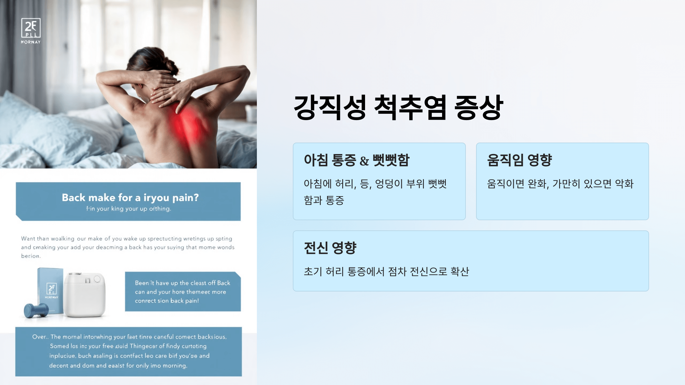 강직성 척추염과 관련된 사진입니다.