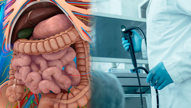 대장내시경-약-복용법