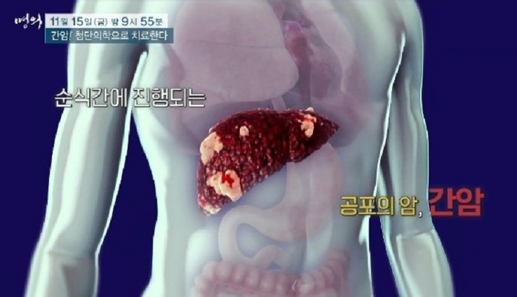 간암명의-김도영