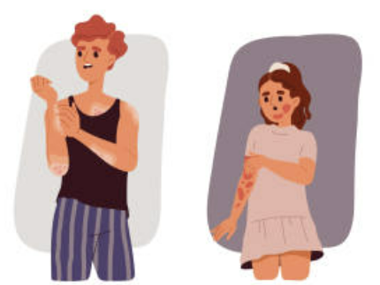 대상포진 예방접종 가격(최저가) 초기증상 치료방법 총정리