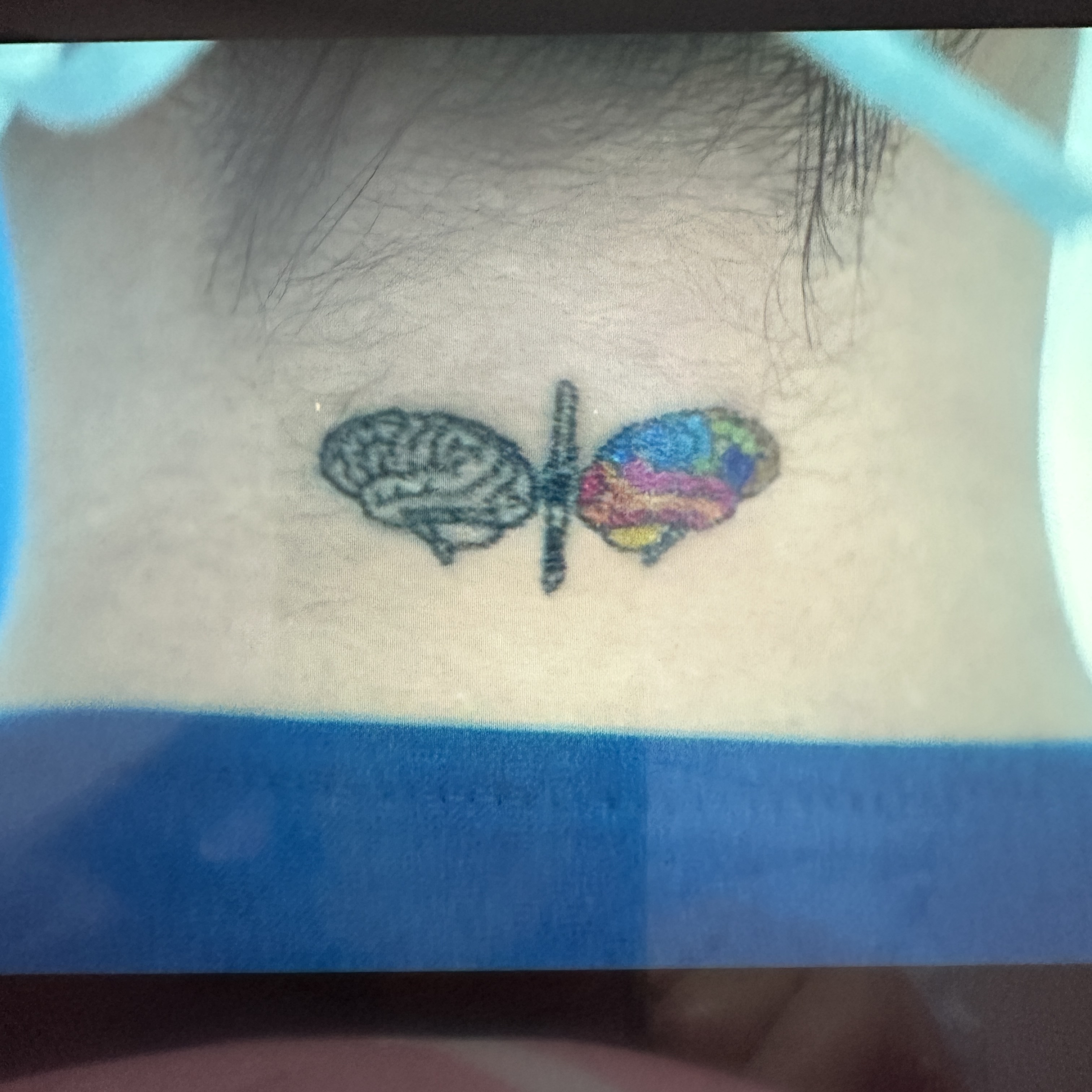 하이퍼나이프_박은빈_1화_타투