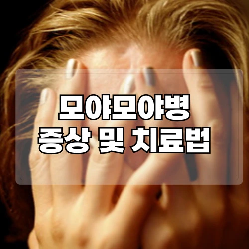 모야모야병-증상-및-치료법