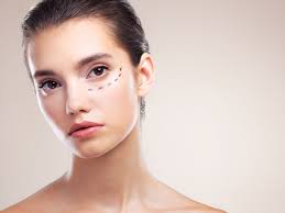 눈밑지방재배치