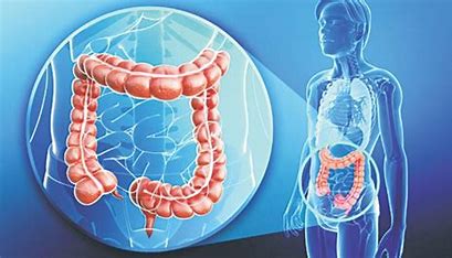 직장암-초기증상-원인-대처및-예방방법
