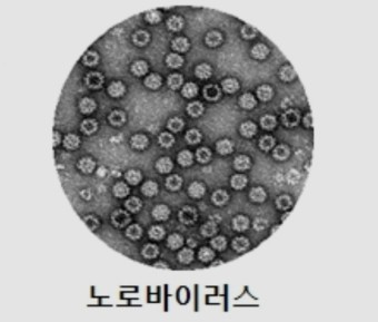 노로바이러스
