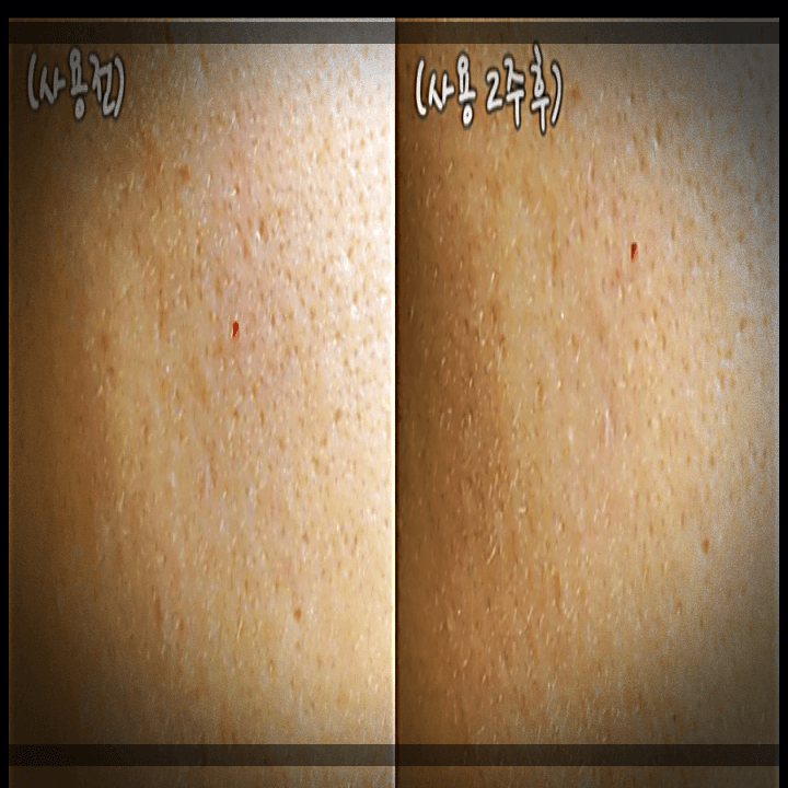 에버콜라겐-인앤업플러스-사용-후기