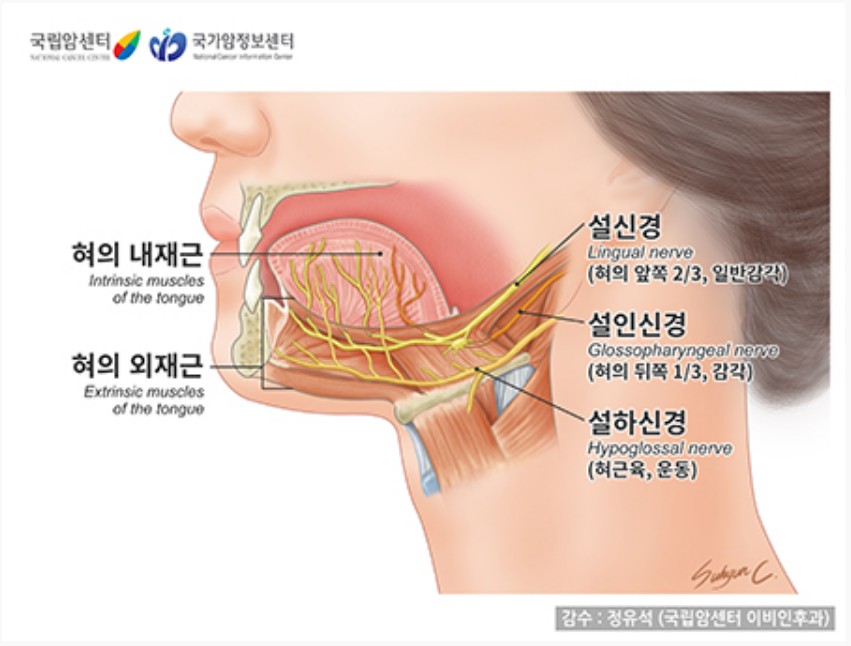설암 투병 정미애