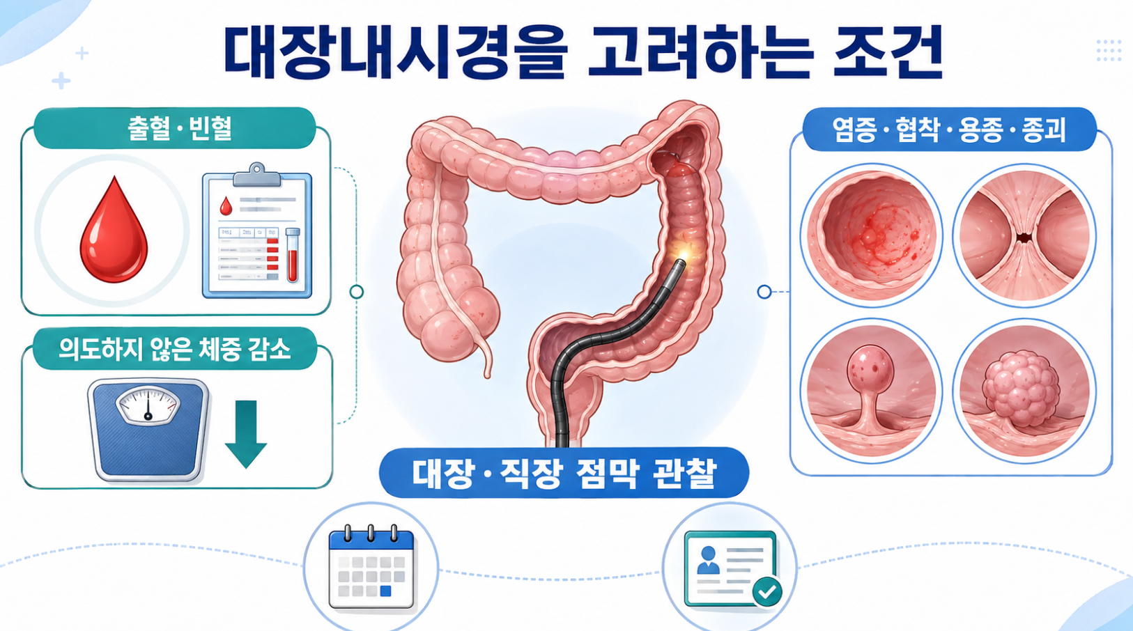 새 변비에서 출혈·빈혈·체중 감소 등 대장내시경을 고려하는 조건과 검사 역할