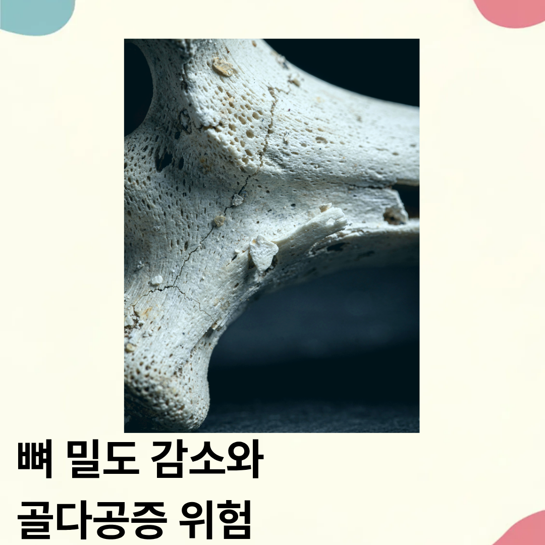 골다공증 수치