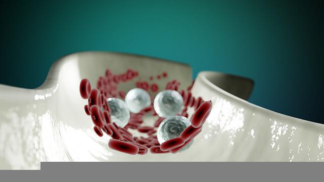 고지혈증 동맥경화