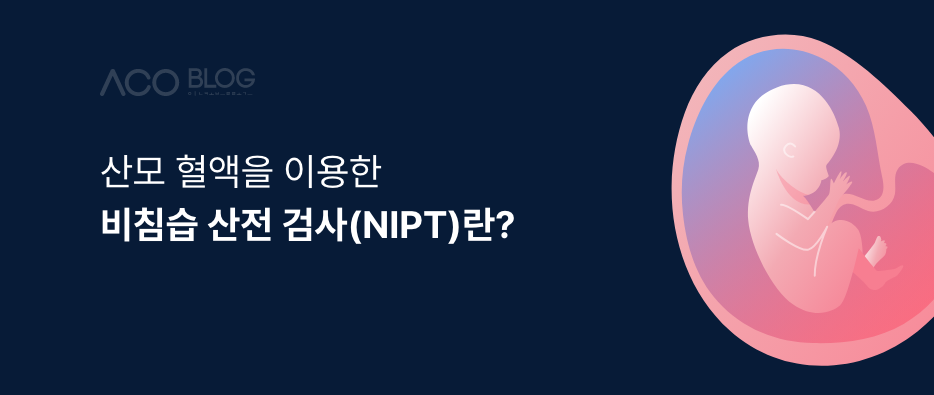 비침습 산전 검사