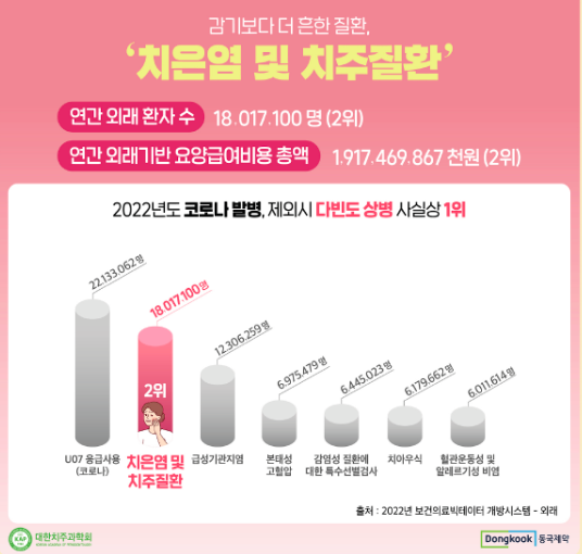 치은염-치주질환