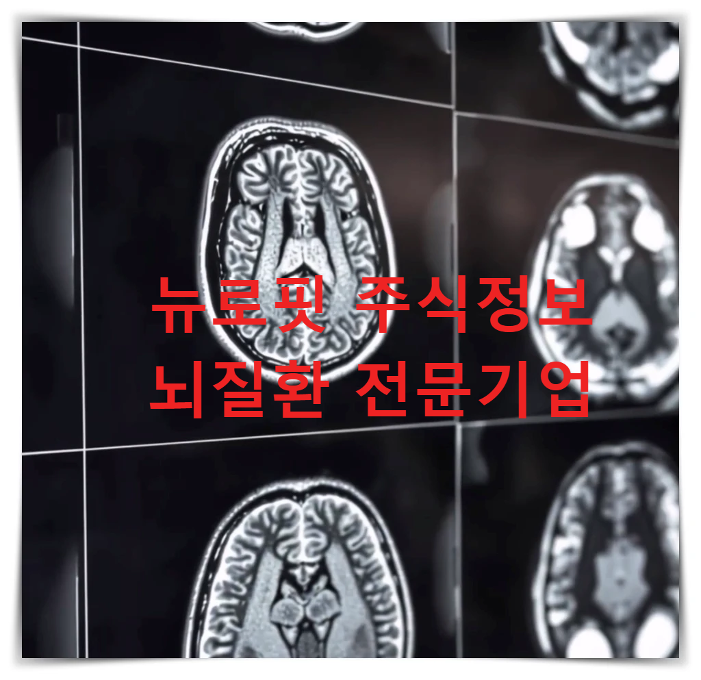 뉴로핏-뇌질환-전문기업