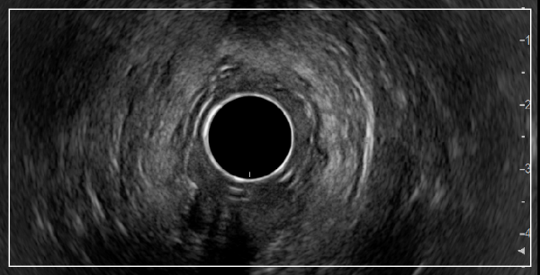 양주예쓰병원 대장항문외과