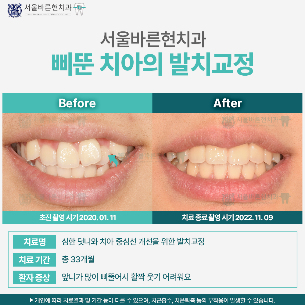 부산교정치과