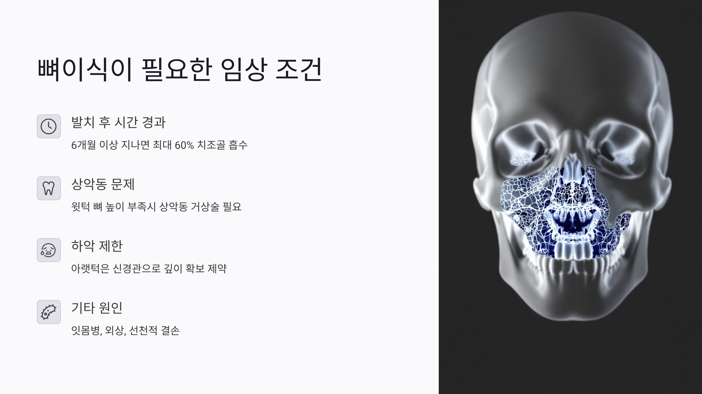 뼈이식이 필요한 임상 조건 총정리