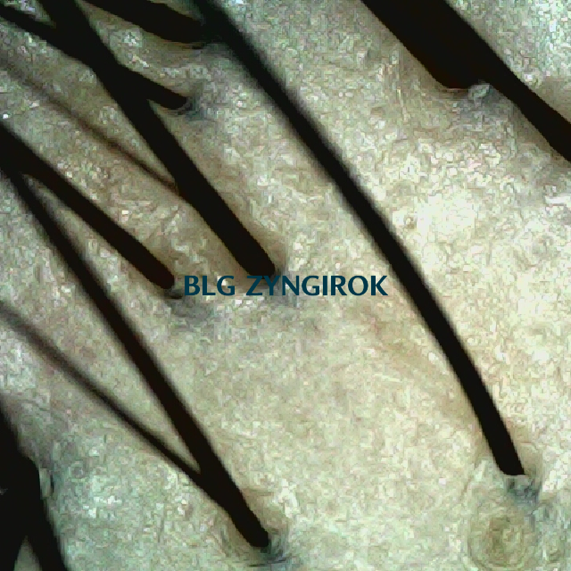 피나모아 복용 9주차 두피사진 - 정수리 위치이다.