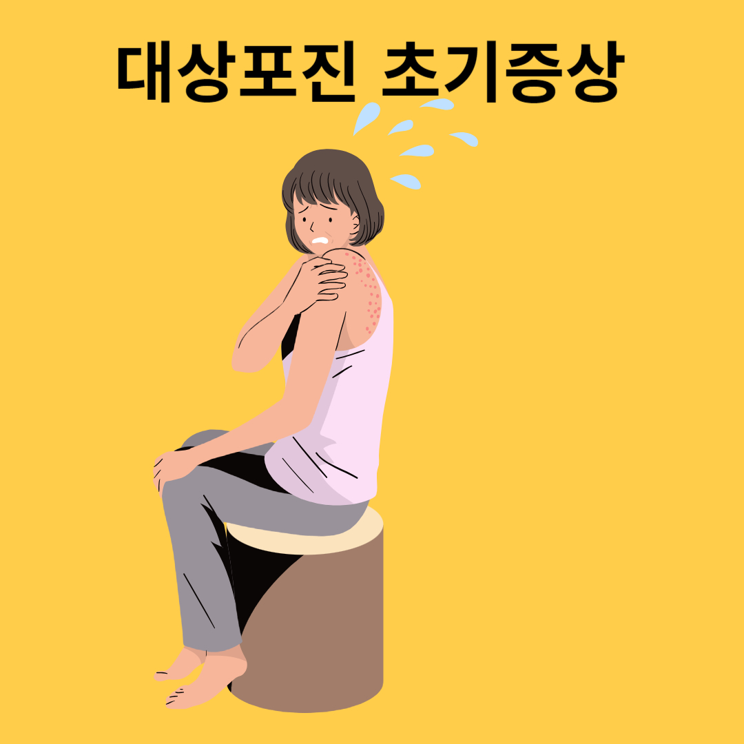 대상포진 초기증상