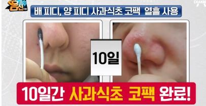 피지없애는방법