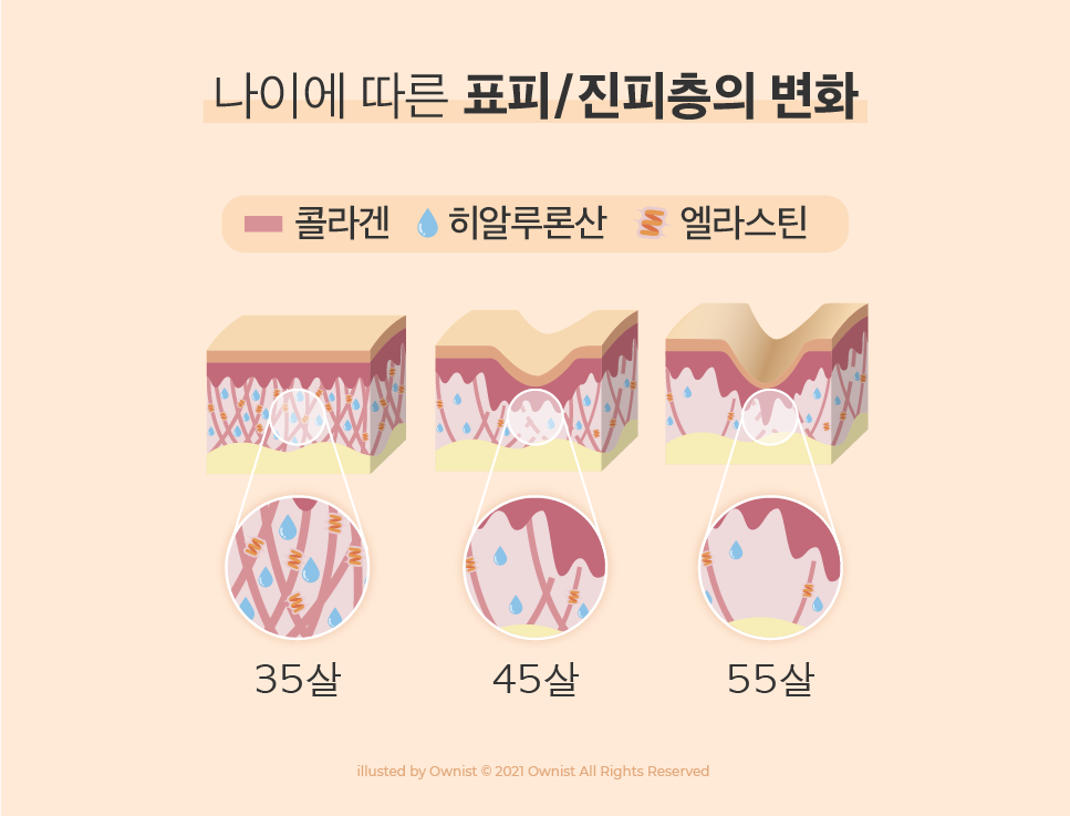 나이에 따른 표피,진피층의 변화 이미지