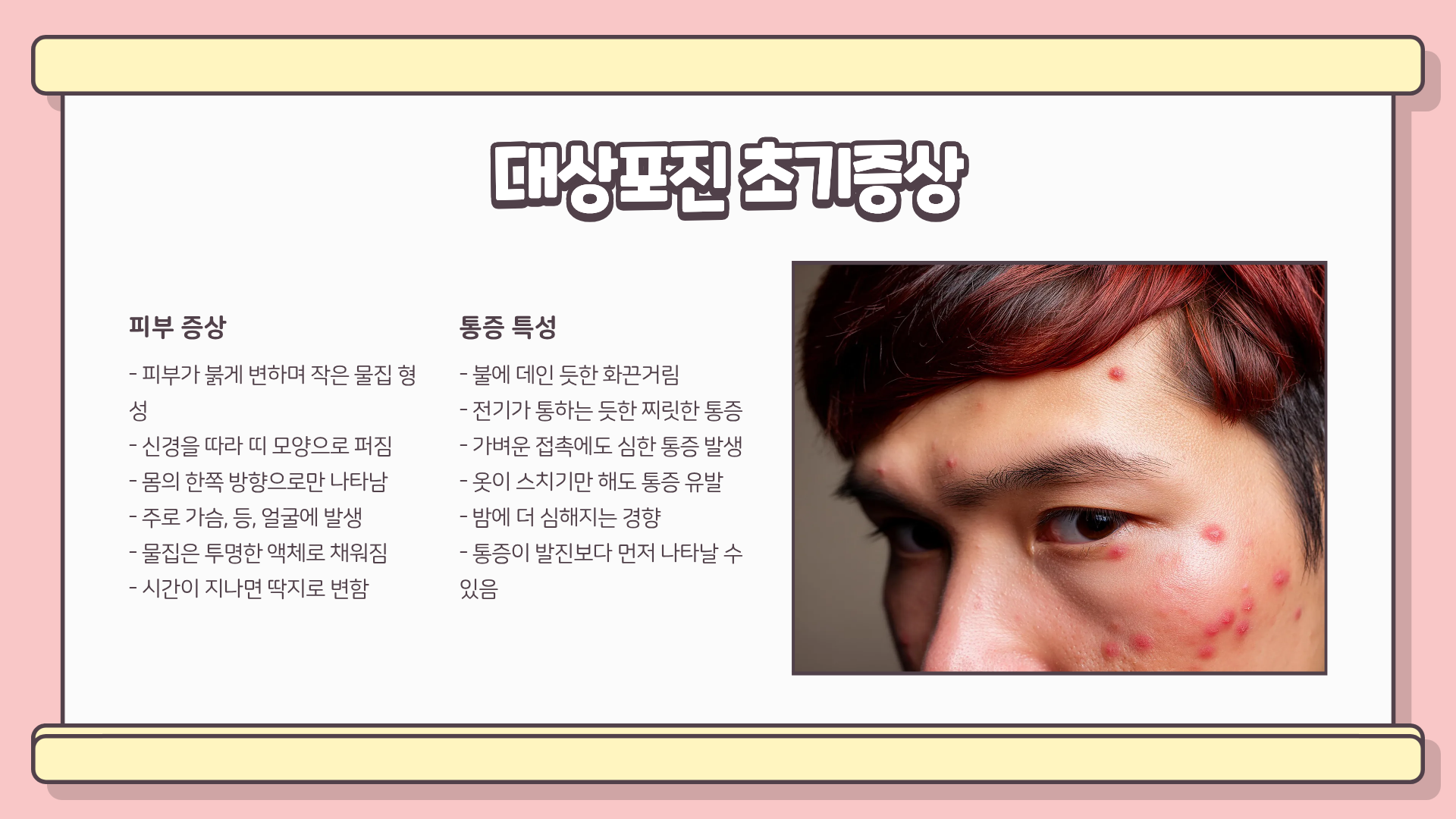 대상포진 예방접종 &amp;#124; 대상포진 전조증상 &amp;#124; 대상포진 치료방법&amp;#44; 안 하면 후회한다